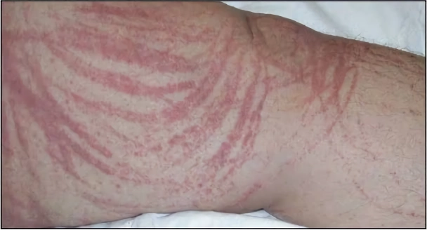 의의로 생으로 먹으면 안되는 음식
