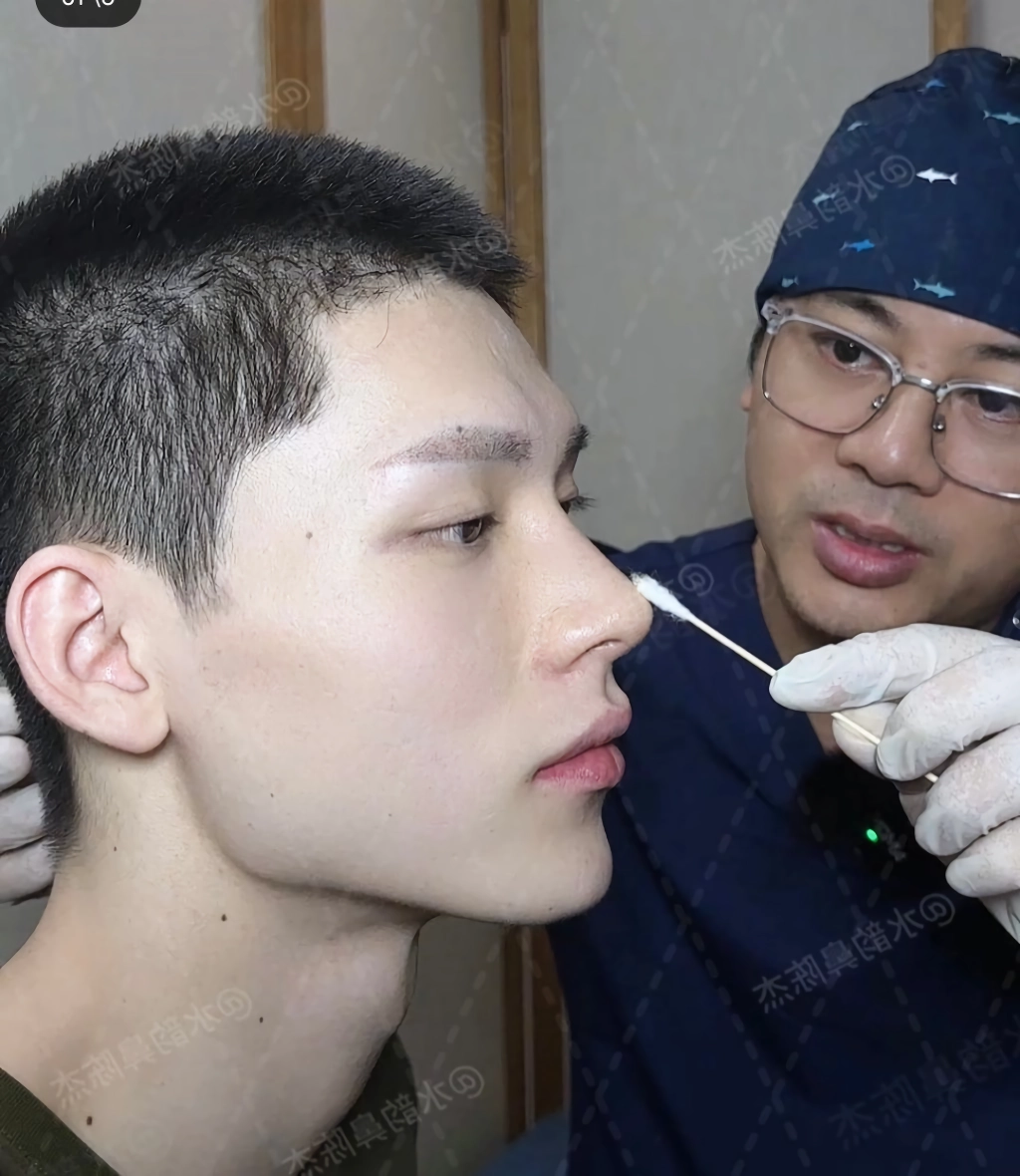 남자 코수술 레전드
