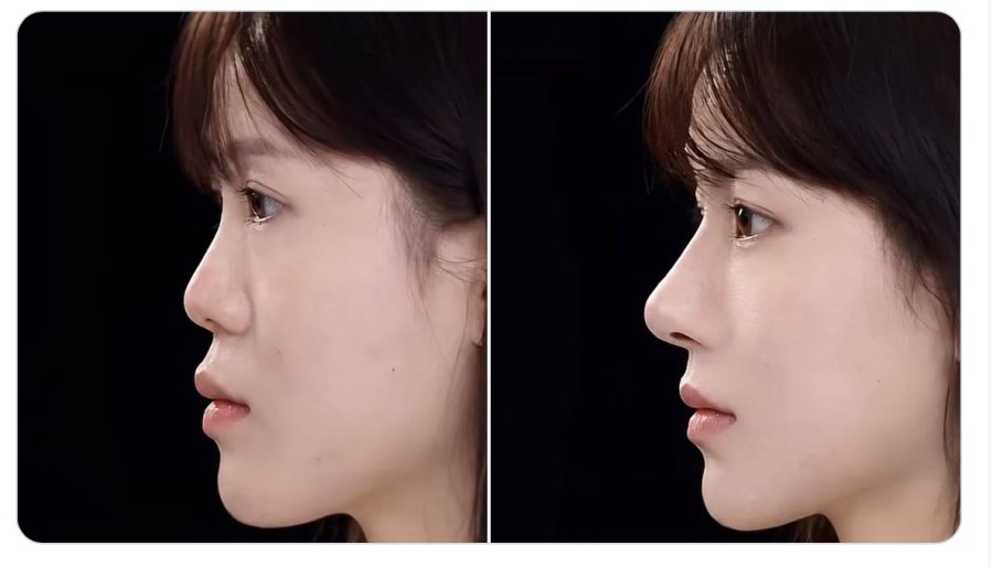 코의 중요성