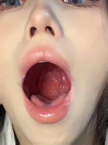 반응 오게 만드는 목구멍 열어 주는 ㅊㅈ