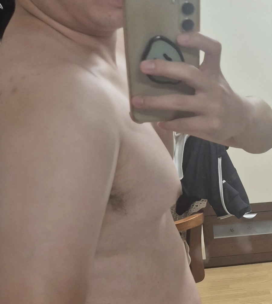 이거 여유증 수술 보험 되나요?
