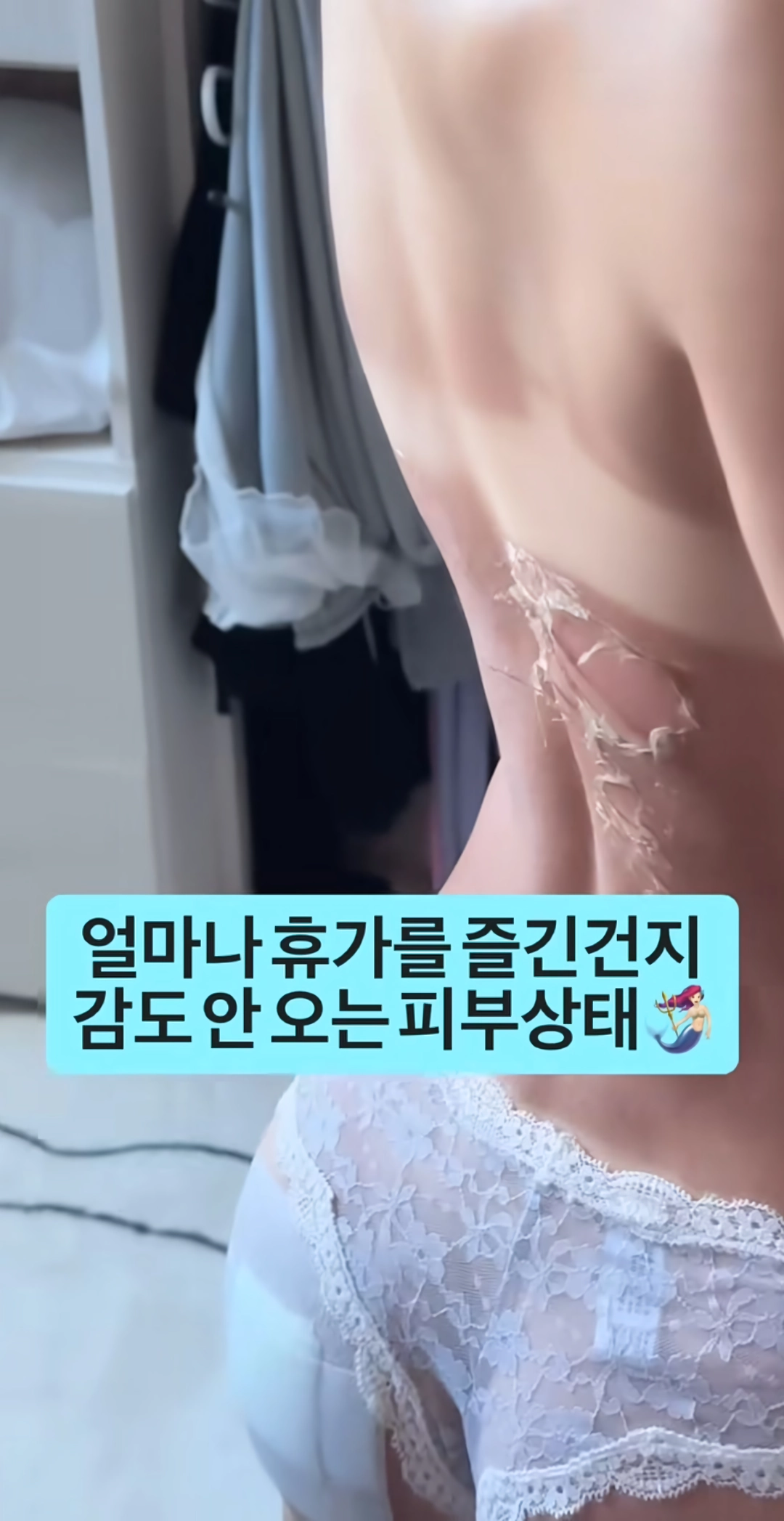 휴가 갔다온 여자의 피부 상태.jpg