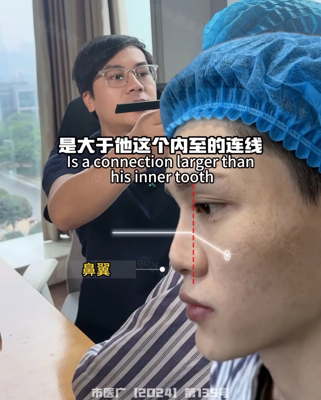 남자 코수술 레전드