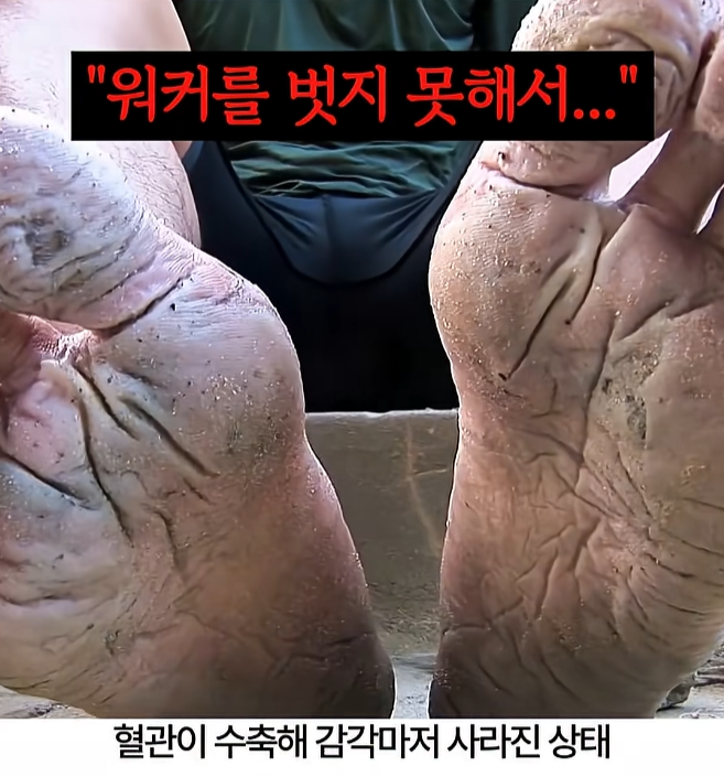 행군 후 군화를 벗으면 보이는