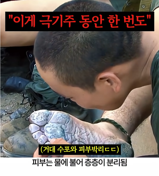 행군 후 군화를 벗으면 보이는