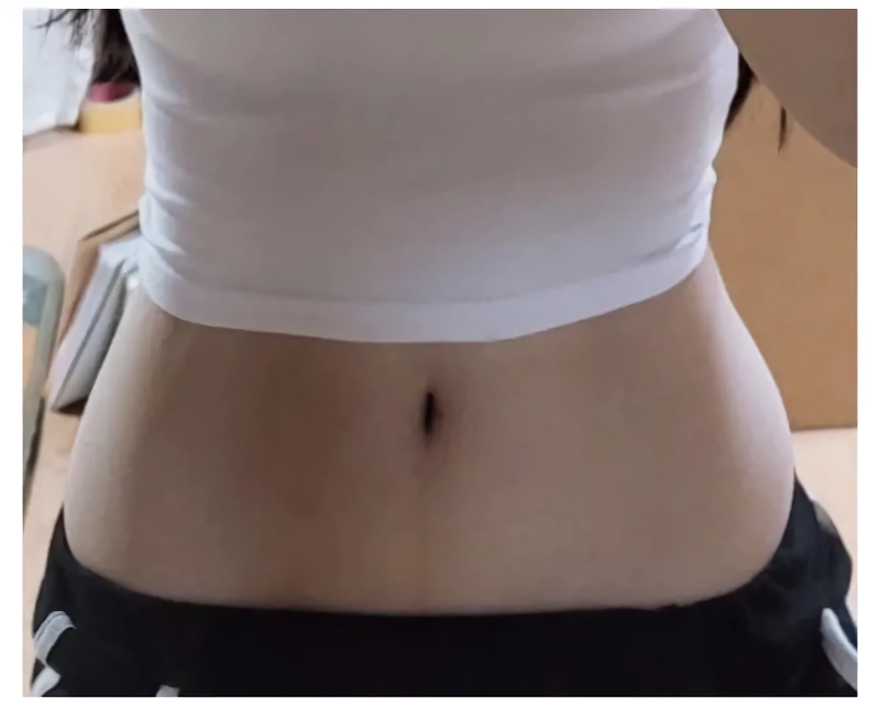 ㅇㅎ?) 탈 코르셋 후기.jpg