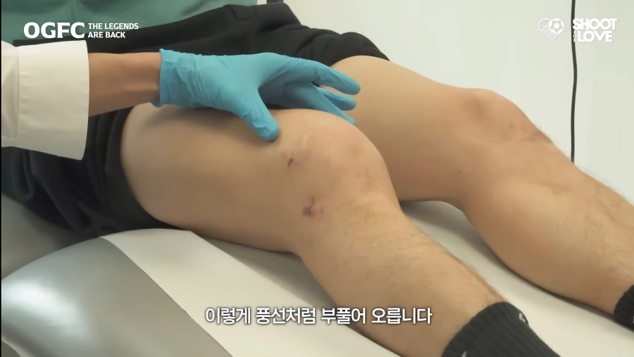 박지성 무릎 근황.jpg