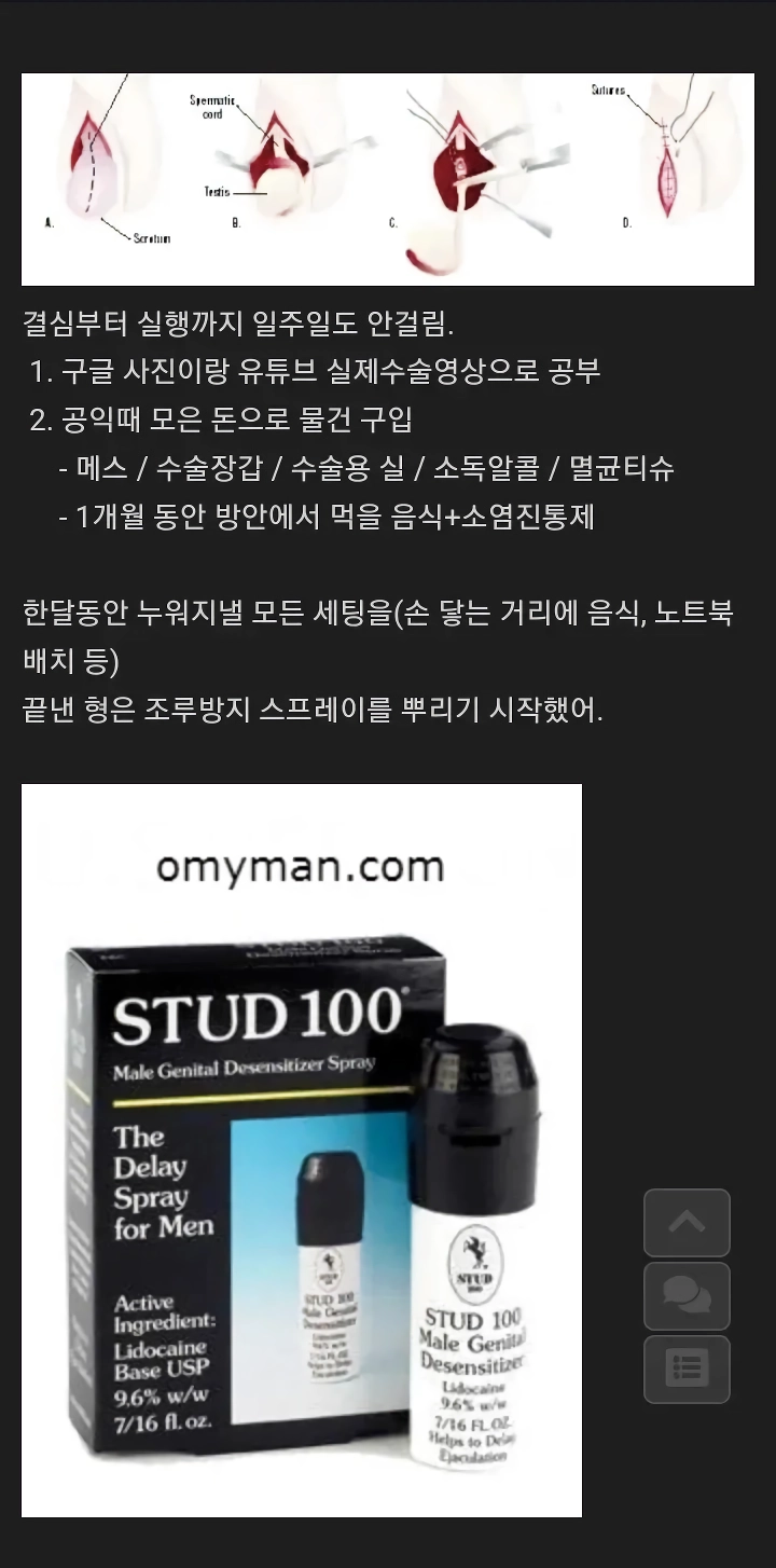 고자 된 사연.jpg