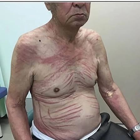 의의로 생으로 먹으면 안되는 음식