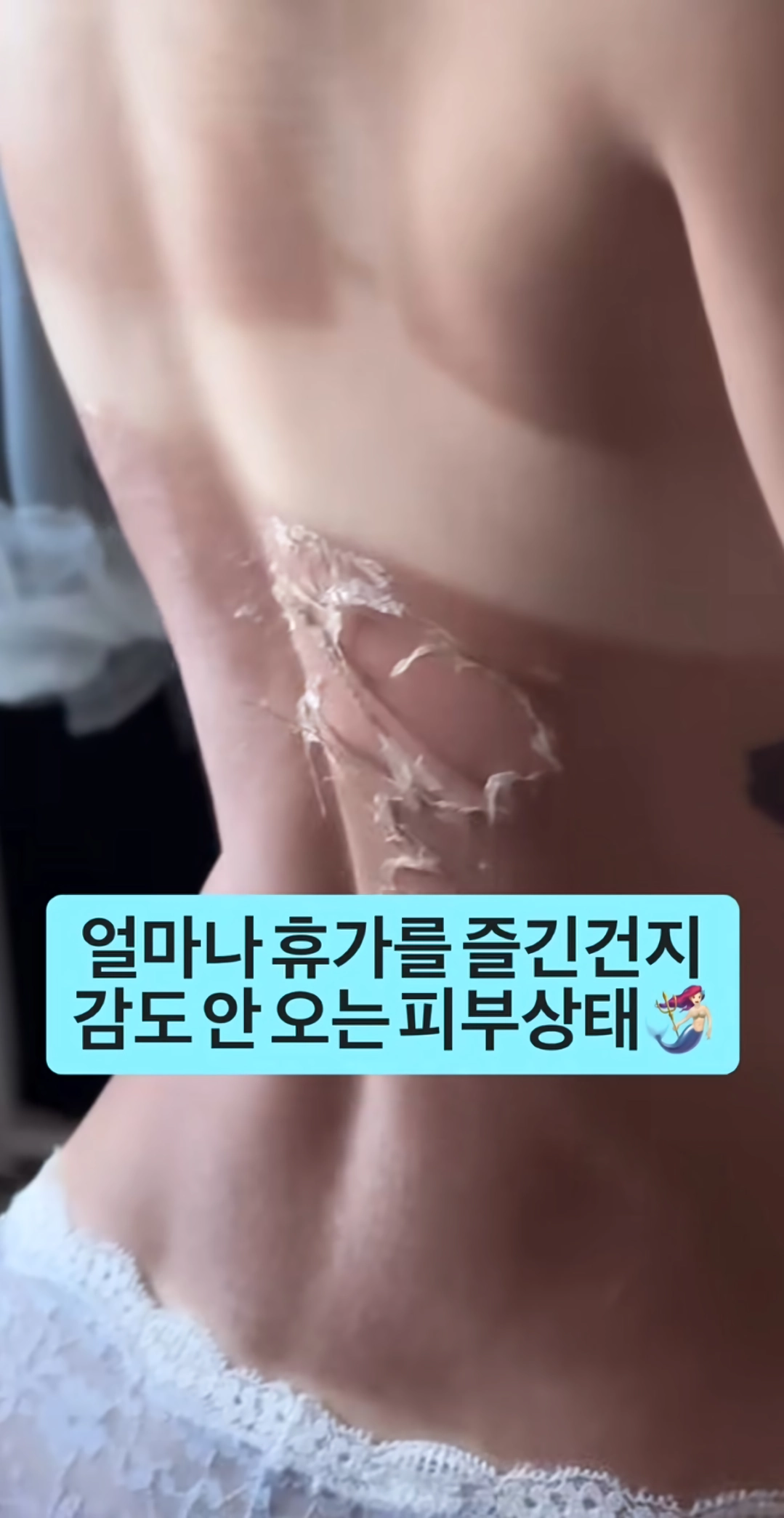 휴가 갔다온 여자의 피부 상태.jpg