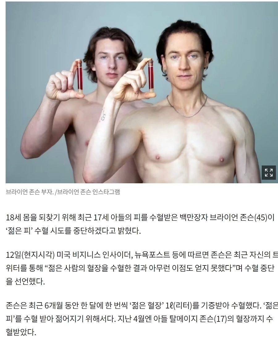 안티에이징으로 유명했던 사람 근황