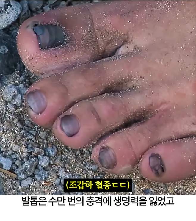 행군 후 군화를 벗으면 보이는