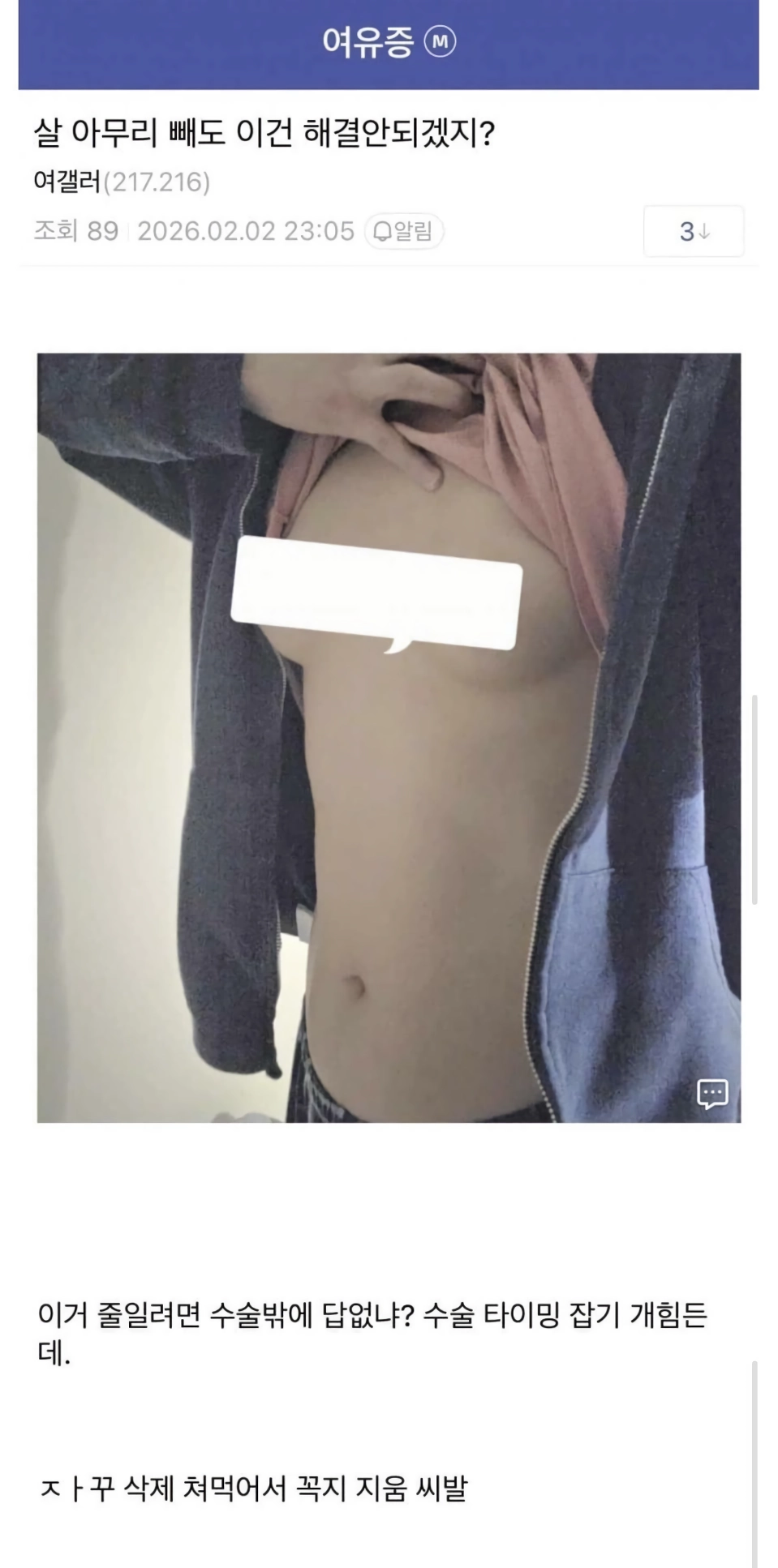 (ㅇㅎ)아무리 살빼도 해결 안되는 것.jpg