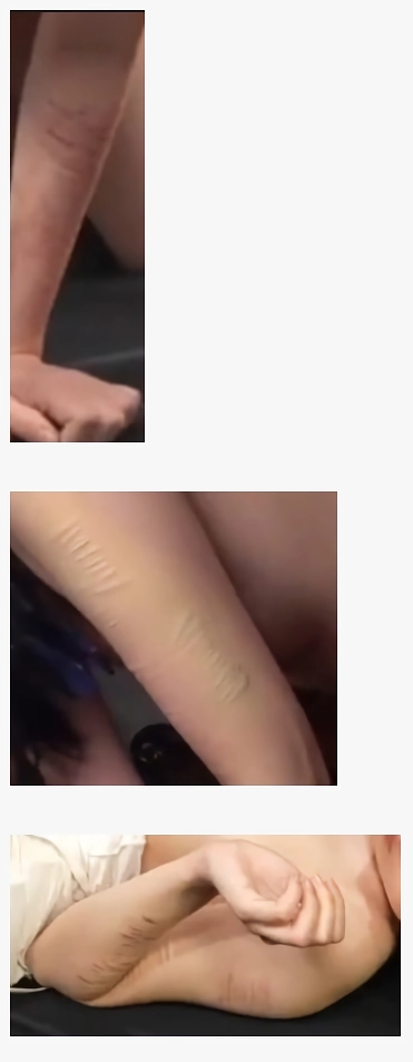 AV 여배우들 팔에 자해자국도 컨셉인가요?