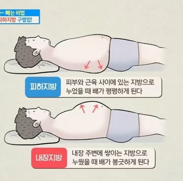 피하지방과 내장지방 차이