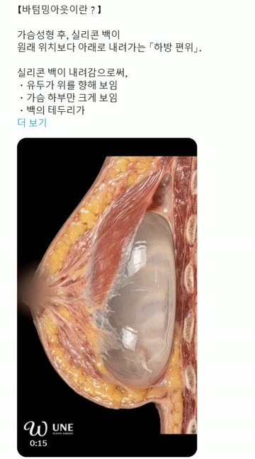 후카다 에이미 찌찌가 못생긴 이유